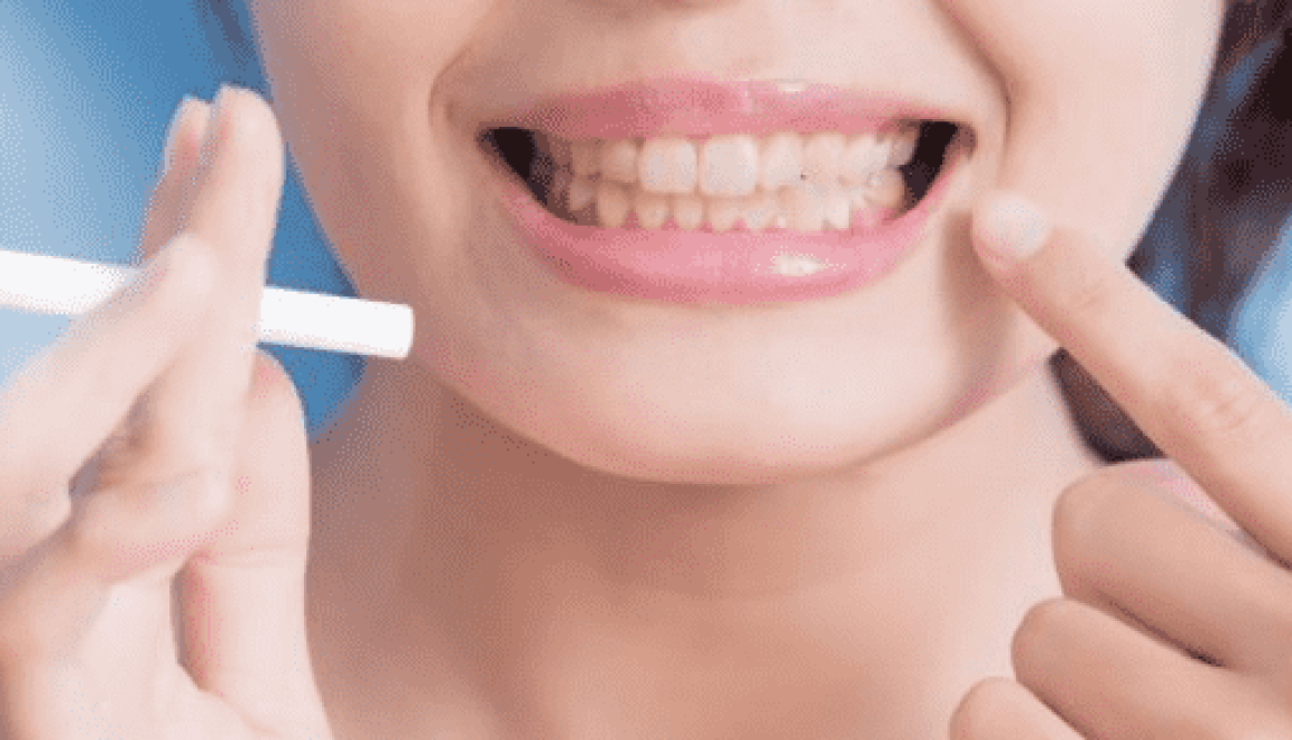 The Impact of Smoking on Oral Health (1)