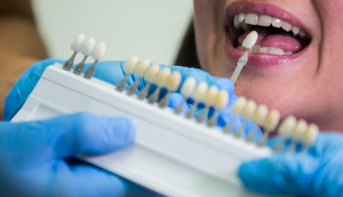 Why is a Night Dental Care Routine Crucial_ (1)