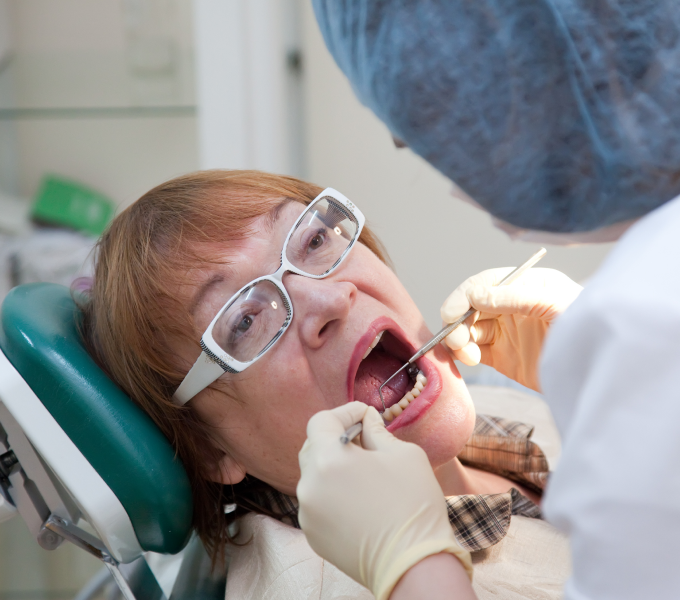 How to Prevent Tooth Decay and Avoid the Need for Fillings
